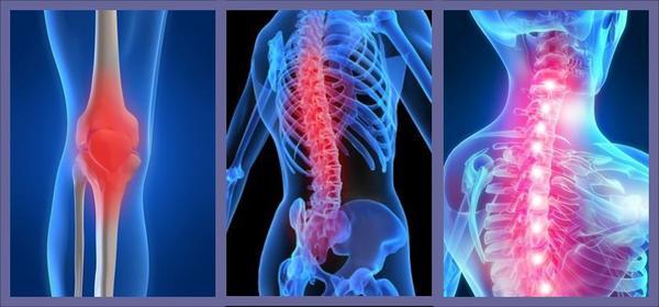 要检查几项才能确诊是强直性脊柱炎？