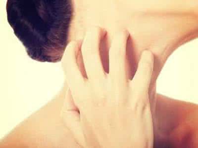 痛风是否会导致患者身上发痒?