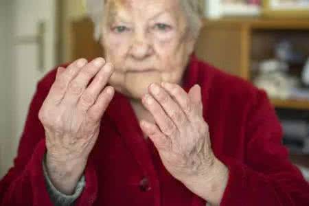 贵阳强直医院风湿免疫科专家：老年人要着重预防老年风湿！