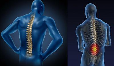 强直性脊柱炎护理有原则，具体有哪些？