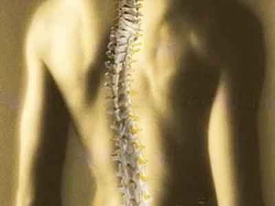 强直性脊柱炎到了后期关节会不会畸形的很厉害？
