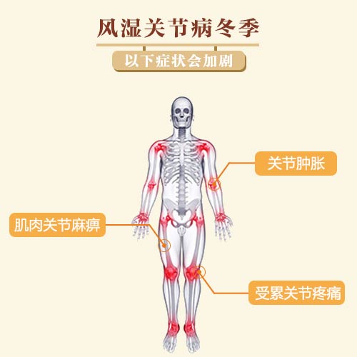 风湿免疫疾病冬季以下症状会加剧 风湿免疫疾病冬季以下症状会加剧.jpg