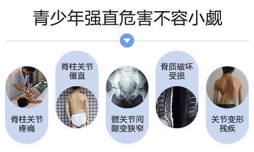 挺直脊梁·圆梦青少年— 2018暑期关爱青少年强直性脊柱炎·AS专项咨询救治平台正式开启 挺直脊梁·圆梦青少年— 2018暑期关爱青少年强直性脊柱炎·AS专项咨询救治平台正式开启