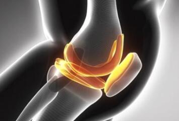 膝关节滑膜炎会引起哪些危害 膝关节滑膜炎的危害