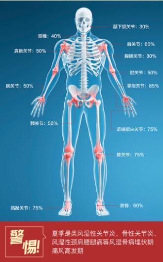 痛风|类风湿夏季防治专题讲座