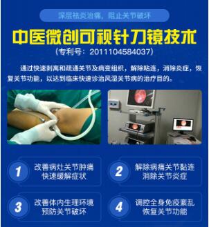 好消息→广州名医来黔0元助诊中医微创可视针刀镜发布会，内附→筛查治疗福利!