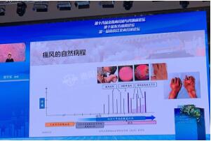 贵阳强直医院林孝义教授