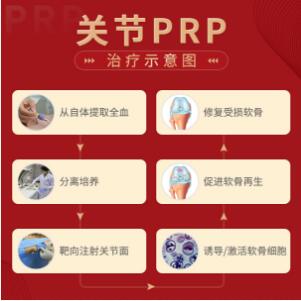 贵阳强直医院PRP技术