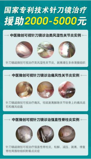 国家专利技术针刀镜治疗援助